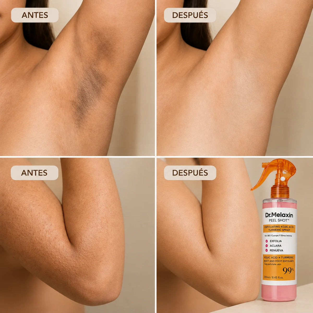 VELORIA® Peel Shot — Exfoliante Corporal en Spray